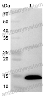 Anti-Monkeypox virus/MPXV A33R Polyclonal Antibody